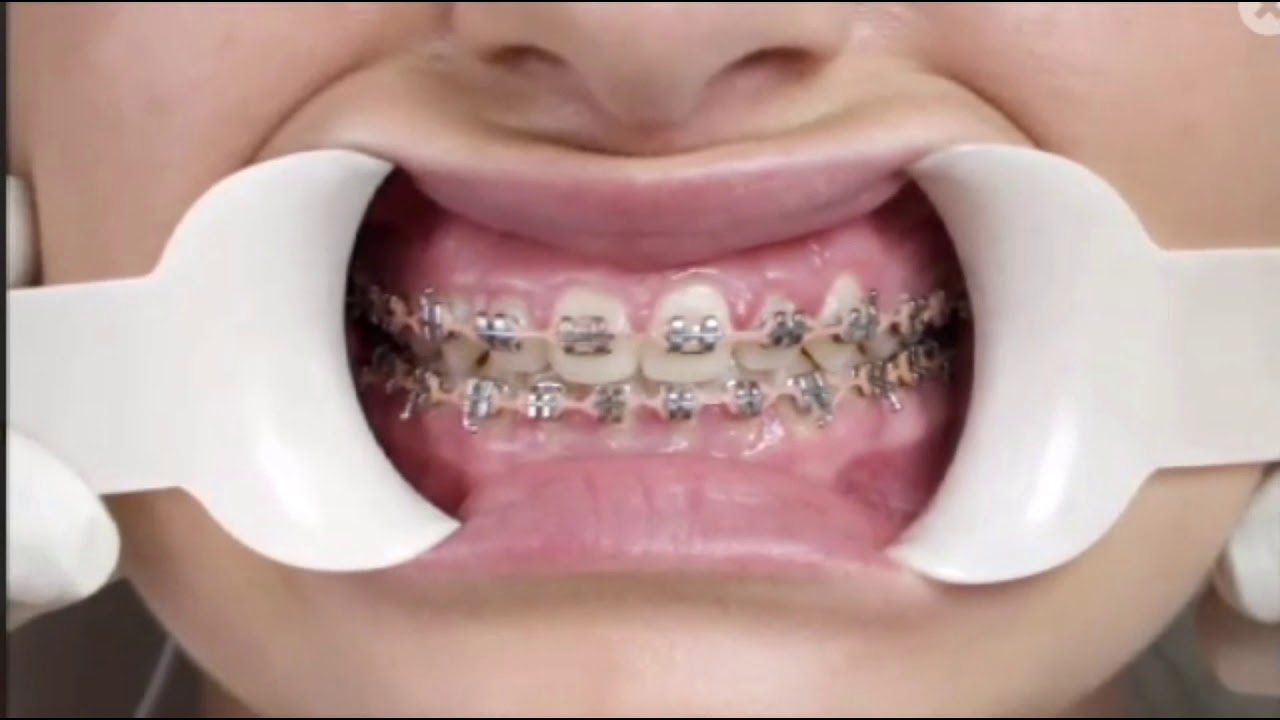 Dentist Downtown Vancouver