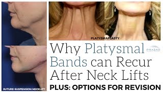 Why Neck Bands can Recur after a Neck Lift, and its Minimally Invasive to Full Surgical Treatments