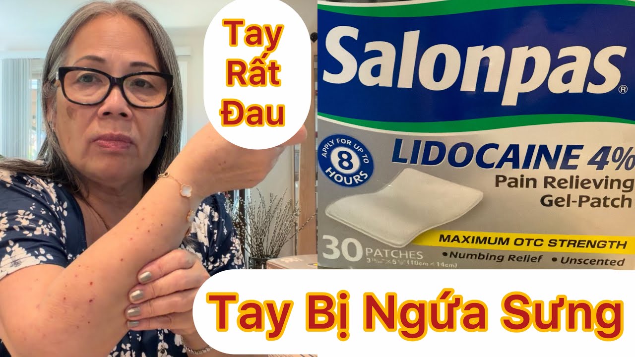 Tập 1969: Quá Đau 😭 Hy Vọng Dùng Loại Salopas LIDOCAZINE 4% Giúp Bớt Đau Và Tay Bị Ngứa Sưng