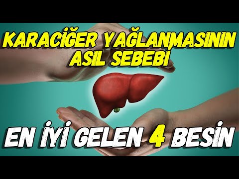 karaci̇ğer yağlanmasinin asil sebebi̇ | en i̇yi gelen 4 besin