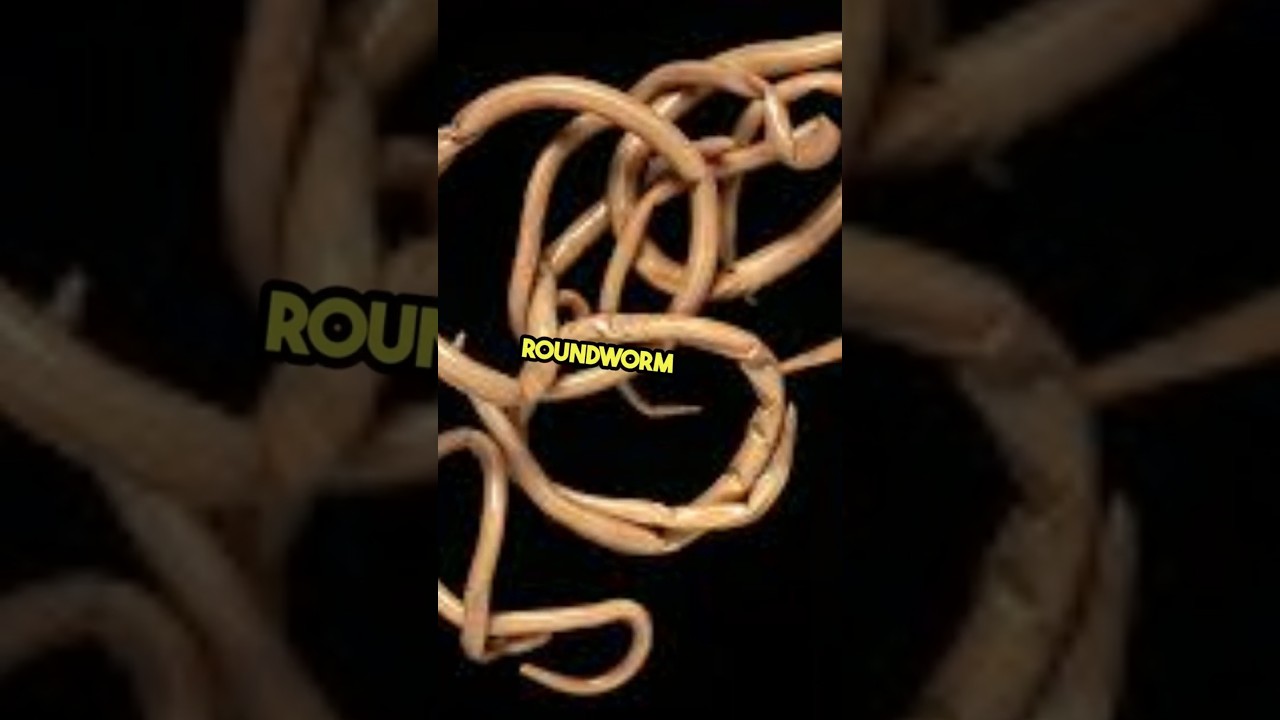 How Many People REALLY Die From Roundworm Every Year? #roundworm #parasite