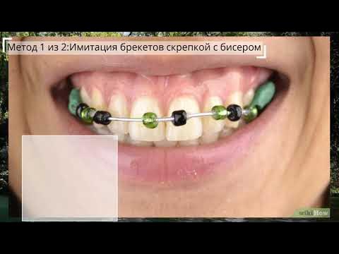 Как сделать искусственные брекеты - YouTube