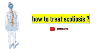 how to treat scoliosis ?