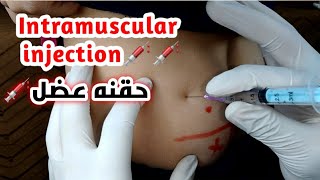 الطريقه الصحيحه لأعطاء الحقن الزيتية عضل_The correct way to inject oil injections into the buttock