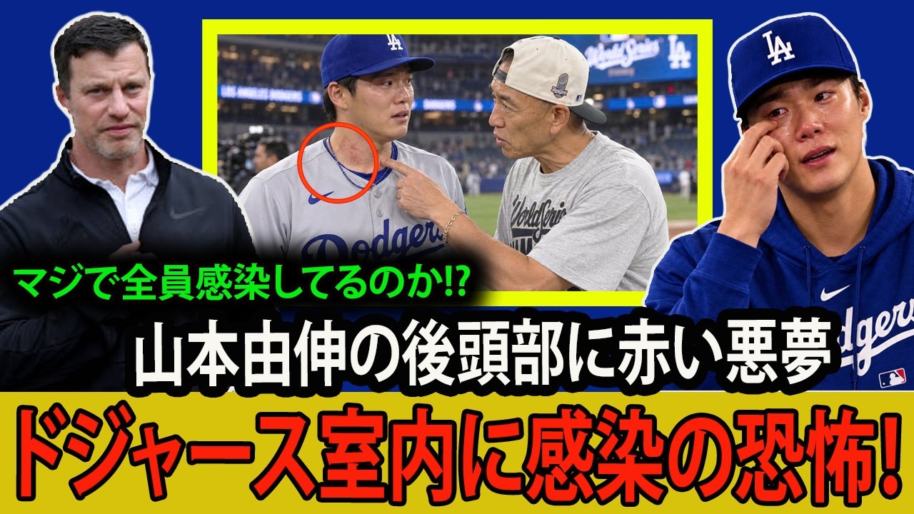 大谷翔平山本由伸　WBCタオル 大谷翔平】「今すぐそのタオルを捨てろ！」山本の後頭部に赤い斑点が
