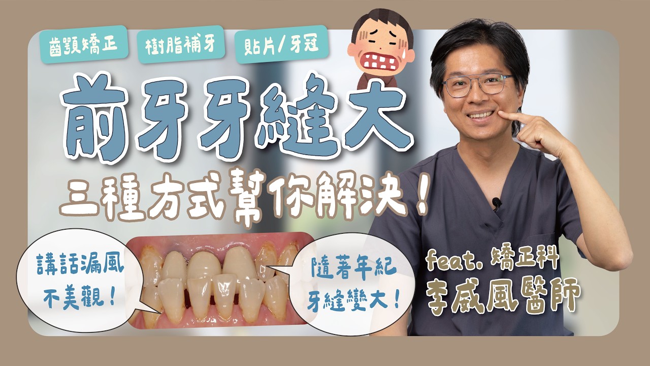「門牙牙縫大」三種方式幫你解決牙縫問題！新竹品御牙醫診所 feat. 李威風醫師 縮圖