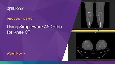 Using Simpleware AS Ortho for Knee CT | Synopsys