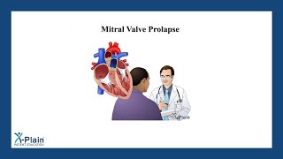 Mitral Valve Prolapse