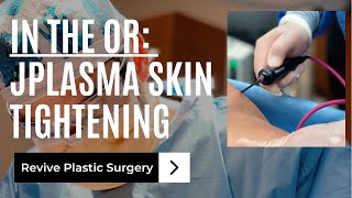 In the OR: JPlasma Skin Tightening