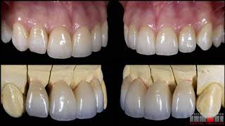 Bopt Antonello Di Felice Stefano Lombardo