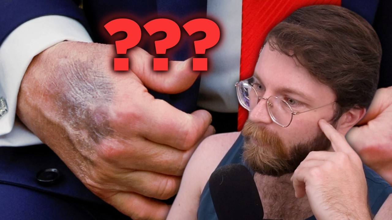 The Day Everyone Thought Trump Died