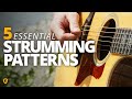 5 Essential Campfire Strumming Patterns - Campfire Guitarist Quick-Start Series #3
