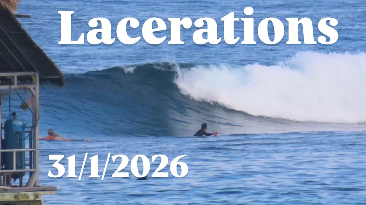 laceration31/1/2026