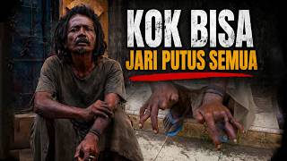 Ya Allah !! Semua Jari bapak ini Hampir Putu5