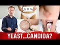 Yeast Infection vs Candida Infection: Is there a Difference? – Dr.Berg