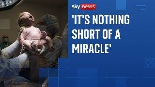 Sky News speaks to the family of the second baby ever to have stem cell surgery