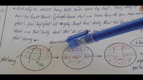 Case 20 | Hội chứng nguy kịch hô hấp cấp | ARDS