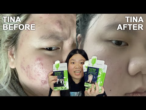how my skin cleared up during quarantine | 2020-2022 skincare routine + YesStyle skincare GIVEAWAY