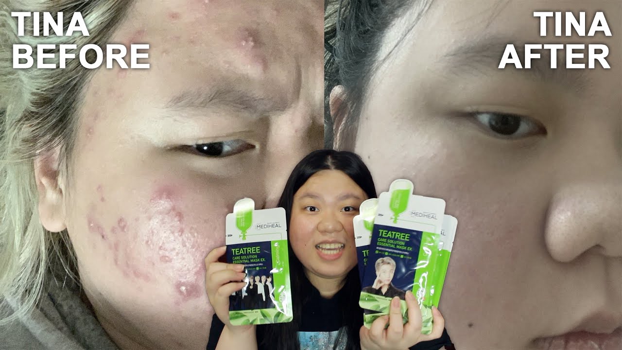 how my skin cleared up during quarantine | 2020-2022 skincare routine + YesStyle skincare GIVEAWAY