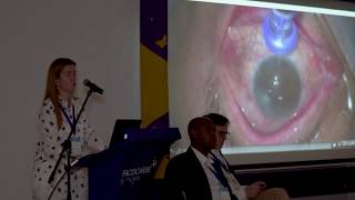 Tratamiento de glaucoma con terapia MicroPulse de IRIDEX - Dra. Maria Fernanda Delgado screenshot 4