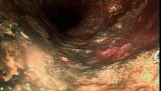 5730 Volsella 123020