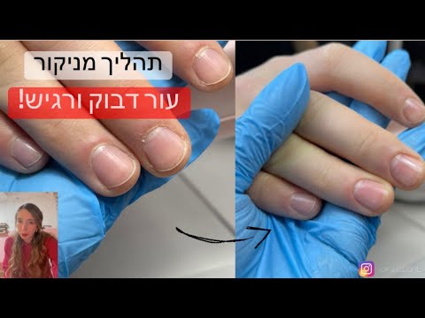 וִידֵאוֹ: 5 דרכים לנקות עור רע