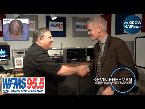 latest-hair-transplant-vip-|-kevin-freeman-from-95.5-wfms