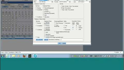 QSI Views and Filters
