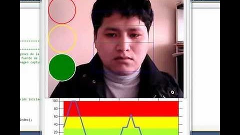 Drowsy Driver Monitoring