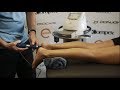 Shockwave Therapy for Chronic Plantar Fasciitis - 6S Health
