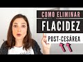 Cómo ELIMINAR la FLACIDEZ después de #CESÁREA 🔥3 PASOS para acabar con ella 🙅‍♀️