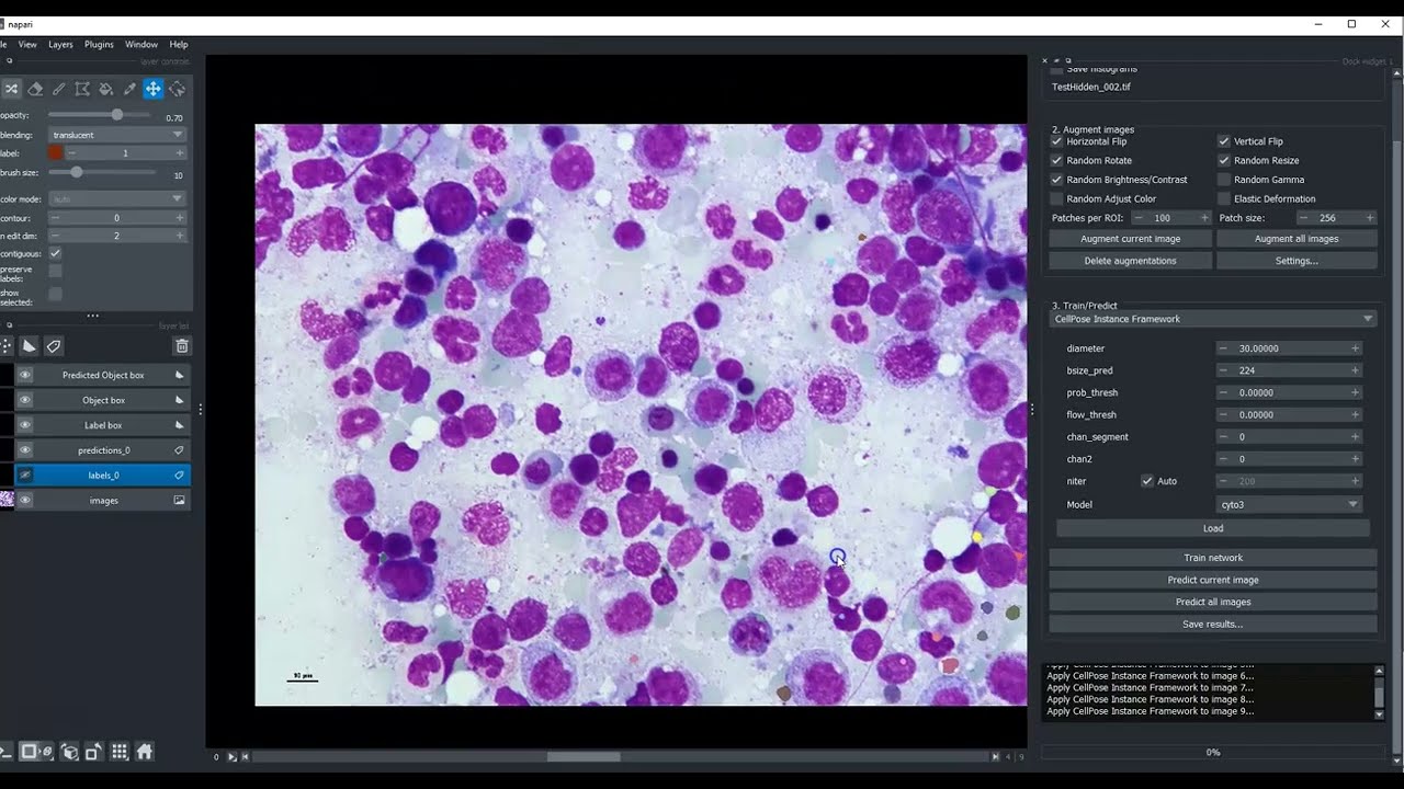 Pixi and Napari-Easy-augment-Batch-DL