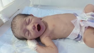 Newborn baby Grunting diagnosis ♥️❤️💕