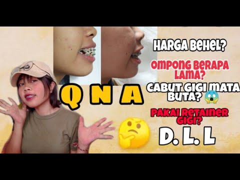 Q N A PERAWATAN  BEHEL  GIGI BIAYA BEHEL  CABUT GIGI 