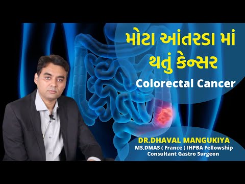 Colorectal Cancer | મોટા આંતરડા માં થતું કેન્સર | DR.DHAVAL MANGUKIYA