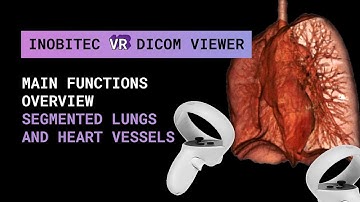 Inobitec VR DICOM Viewer functionality overview. Segmented lungs and heart vessels
