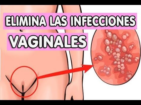 Como eliminar los mocos del pecho