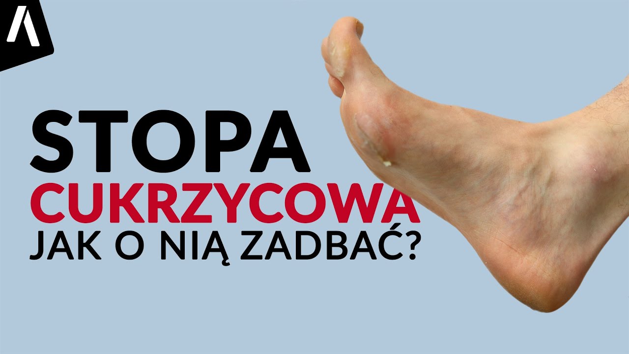 Od Czego Zależy Stopień Dysocjacji Stopa cukrzycowa I Czym jest i jak zadbać o stopę cukrzycową? - YouTube