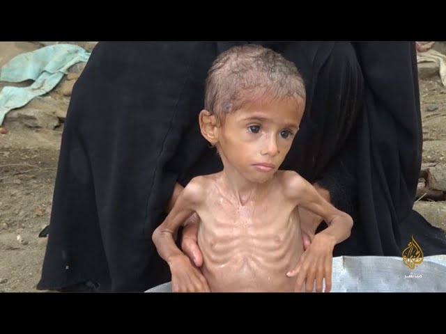 حرب اليمن تقطع طريق الأب إلى العمل.. وطفله الصغير يتضور جوعا
