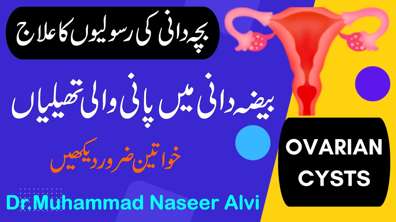 Ovarian cyst treatment bacha dani me pani theli ka ilaj in urdu YouTube