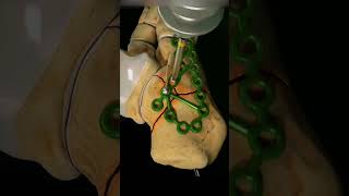 Most Painful Bone to Break? How much force does it take?? #shorts