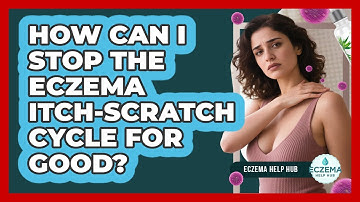 How Can I Stop The Eczema Itch-scratch Cycle For Good? - Eczema Help Hub