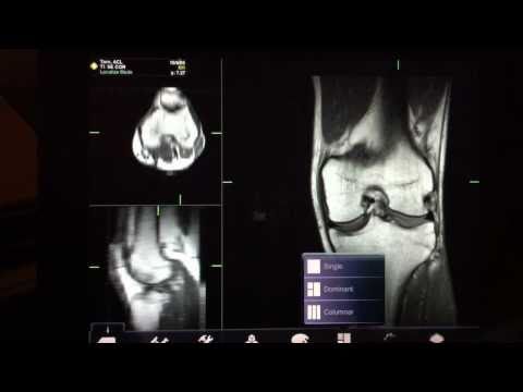 Mobile MIM iPad radiology app