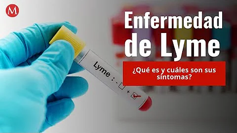 ¿Qué tiene los mismos síntomas que la enfermedad de Lyme?