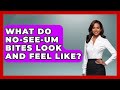 No-see-um Bites: Appearance & How to Manage 🦟