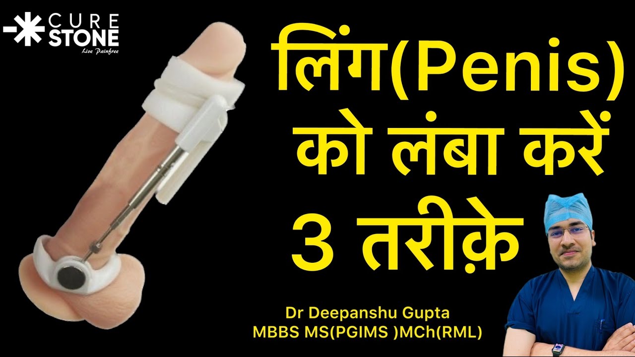 लिंग को लंबा करें 3 तऱीके से? Ling lamba karne ke 3 tarike | How to  increase penis length by surgery - YouTube