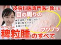 【実は簡単!】皮膚科専門医が教える目の周りのブツブツ「稗粒腫」の治し方と予防法