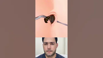 تنظيف السرة اكسبلور 