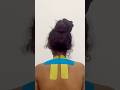 Neck Pain Treatment #KinesiologyTaping #Physiotherapy #PainRelief #InjuryRecovery #SportsInjury