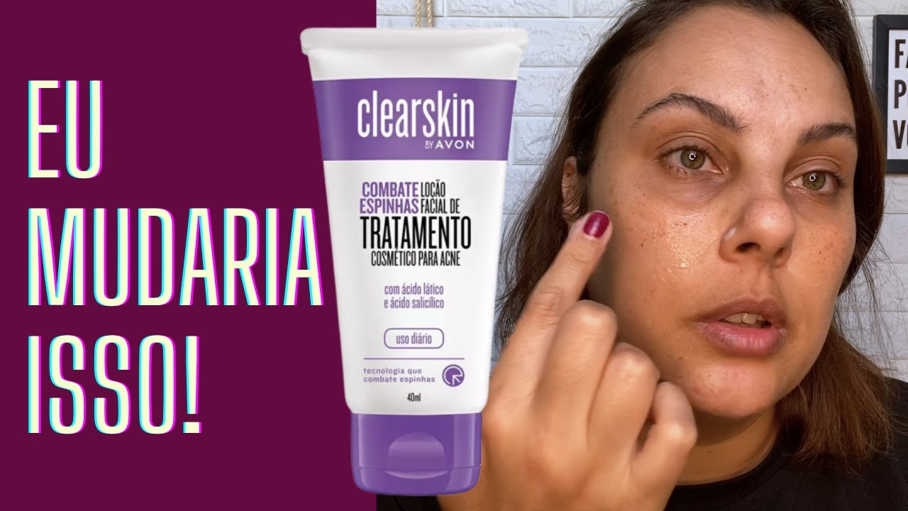 LOÇÃO FACIAL DE TRATAMENTO COSMÉTICO DE ACNE CLEARSKIN AVON RESENHA